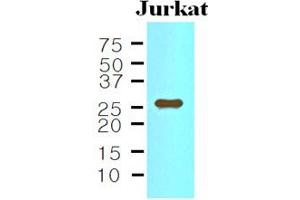 Western blot analysis: The Cell lysates of Jurkat (35ug) were resolved by SDS-PAGE, transferred to NC membrane and probed with anti-human IL-33 (1:500). (IL-33 抗体)