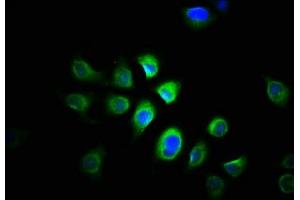 Immunofluorescence staining of A549 cells with ABIN7165056 at 1:166, counter-stained with DAPI.