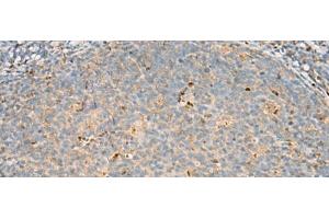 Immunohistochemistry of paraffin-embedded Human tonsil tissue using DNPEP Polyclonal Antibody at dilution of 1:60(x200) (Aspartyl Aminopeptidase 抗体)