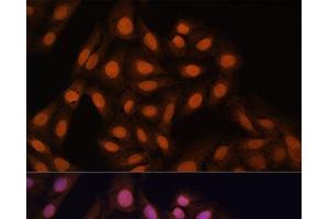 Immunofluorescence analysis of U-2 OS cells using CBX3 Polyclonal Antibody at dilution of 1:100. (CBX3 抗体)