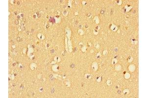 Immunohistochemistry of paraffin-embedded human brain tissue using ABIN7171961 at dilution of 1:100 (TGFBR2 抗体  (AA 25-159))