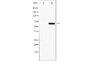 Western blot analysis of FRS2 phosphorylation expression in COS7 whole cell lysates,The lane on the left is treated with the antigen-specific peptide. (FRS2 抗体  (pTyr436))