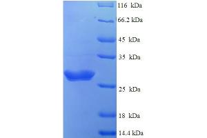 SDS-PAGE (SDS) image for Bovine Coronavirus Spike Protein (BCoV S) (AA 326-540), (partial) protein (His tag) (ABIN5710878)