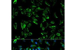 Immunofluorescence analysis of HeLa cells using TPM3 Polyclonal Antibody (TPM3 抗体)