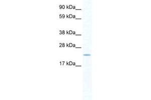 Western Blotting (WB) image for anti-SERTA Domain Containing 1 (SERTAD1) antibody (ABIN2460913) (SERTAD1 抗体)