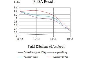 Black line: Control Antigen (100 ng),Purple line: Antigen (10 ng), Blue line: Antigen (50 ng), Red line:Antigen (100 ng) (ATR 抗体  (AA 366-550))