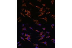 Immunofluorescence analysis of L929 cells using RPS17 antibody (ABIN7270016) at dilution of 1:100. (RPS17 抗体  (AA 1-100))