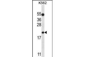 BAX Antibody (N-term) (ABIN657135 and ABIN2846276) western blot analysis in K562 cell line lysates (35 μg/lane). (BAX 抗体  (N-Term))