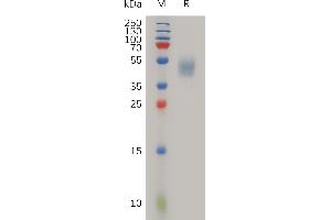 Human PLAUR Protein, His Tag on SDS-PAGE under reducing condition.