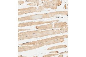 Immunohistochemical analysis of paraffin-embedded human skeletal muscle tissue using (ABIN654335 and ABIN2844108) performed on the Leica® BOND RXm.