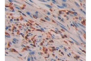 Immunohistochemistry (IHC) image for anti-Interleukin 16 (IL16) (AA 1203-1332) antibody (ABIN7430693)