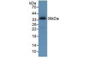 Western blot analysis of recombinant Human ROS1. (ROS1 抗体)