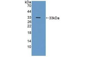Detection of Recombinant ICAM3, Human using Polyclonal Antibody to Intercellular Adhesion Molecule 3 (ICAM3)