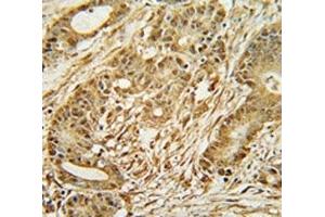 Immunohistochemistry (IHC) image for anti-Minichromosome Maintenance Complex Component 2 (MCM2) (AA 649-677) antibody (ABIN3031801)