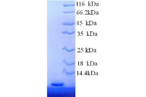 Metallothionein 2 (MT2) (AA 1-59), (partial) protein (His tag)