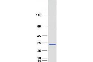 Western Blotting (WB) image for ES cell expressed Ras (ERAS) protein (Myc-DYKDDDDK Tag) (ABIN2720363)