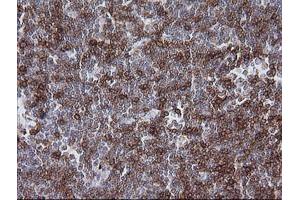 Immunohistochemistry (IHC) image for anti-T-cell surface glycoprotein CD1c (CD1C) antibody (ABIN2670667) (CD1c 抗体)