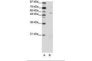 Image no. 1 for anti-Zinc Finger Protein 329 (ZNF329) (N-Term) antibody (ABIN202735) (ZNF329 抗体  (N-Term))
