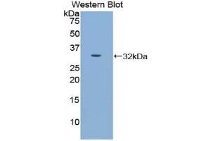 Detection of Recombinant CDH16, Mouse using Polyclonal Antibody to Cadherin 16 (CDH16) (Cadherin-16 抗体  (AA 353-617))