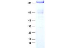 Western Blotting (WB) image for Tripartite Motif Containing 33 (TRIM33) protein (DYKDDDDK Tag) (ABIN2733720)