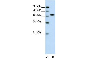 WB Suggested Anti-SOX11 Antibody Titration:  0. (SOX11 抗体  (N-Term))