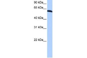 WB Suggested Anti-TRIP6 Antibody Titration:  0. (TRIP6 抗体  (N-Term))