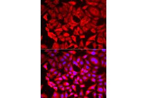 Immunofluorescence analysis of HeLa cell using SRP19 antibody. (SRP19 抗体)