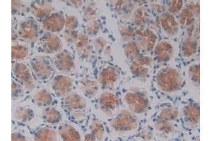 Detection of OSM in Human Stomach Tissue using Polyclonal Antibody to Oncostatin M (OSM) (Oncostatin M 抗体  (AA 26-220))