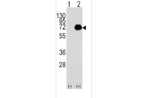 Western blot analysis of ACOX1 using rabbit polyclonal ACOX1 Antibody using 293 cell lysates (2 ug/lane) either nontransfected (Lane 1) or transiently transfected with the ACOX1 gene (Lane 2).