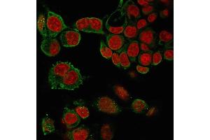 Immunofluorescence staining of paraformaldehyde-fixed HePG2 cells with TNF alpha Mouse Monoclonal Antibody (4C6-H8) followed by goat anti-Mouse IgG-CF488 (Green). (TNF alpha 抗体  (AA 115-130))