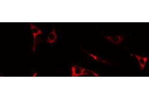 ABIN6274673 staining LOVO by IF/ICC. (IL17RA 抗体  (N-Term))
