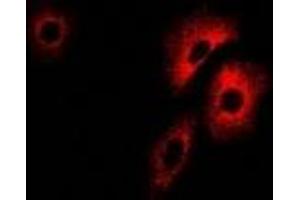 Immunofluorescent analysis of PCCB staining in U2OS cells. (PCCB 抗体)