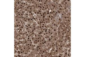 Immunohistochemical staining of human liver with ZBBX polyclonal antibody  shows strong nuclear and cytoplasmic positivity in hepatocytes. (ZBBX 抗体)