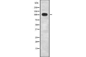 Western blot analysis of INPP4B using LOVO whole  lysates. (INPP4B 抗体  (C-Term))
