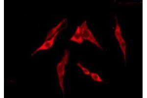 ABIN6276220 staining Hela by IF/ICC. (TAS2R13 抗体  (Internal Region))