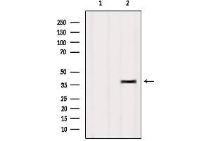Western blot analysis of extracts from HUVEC, using OR4D9 Antibody. (Olfactory Receptor, Family 4, Subfamily D, Member 9 (OR4D9) 抗体)