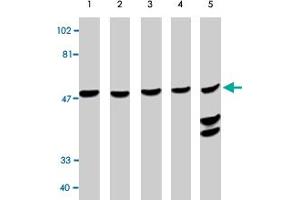 Western blot analysis using CASP10 polyclonal antibody at 0. (Caspase 10 抗体  (AA 505-521))