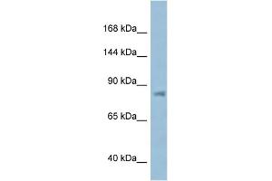 WB Suggested Anti-KPNB1 AntibodyTitration: 1. (KPNB1 抗体  (N-Term))