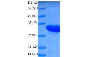 SDS-PAGE (SDS) image for HLA-DR-gamma (CD74) (AA 57-280) protein (His tag) (ABIN1473894)