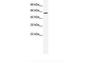 Image no. 1 for anti-Zinc Finger and BTB Domain Containing 44 (ZBTB44) (AA 221-270) antibody (ABIN6735970) (ZBTB44 抗体  (AA 221-270))