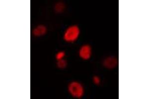 ABIN6274428 staining HuvEc cells by IF/ICC. (HIPK4 抗体  (C-Term))