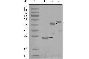 Western blot analysis using KARS mouse mAb against truncated Trx-KARS recombinant protein (1), truncated MBP-KARS (aa90-174) and full length KARS (aa1-188) transfected CHO-K1 cell lysate (3). (KARS 抗体)