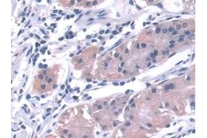 Immunohistochemistry (IHC) image for anti-Kinesin Light Chain 1 (KLC1) (AA 1-254) antibody (ABIN7434992)