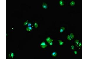 Immunofluorescent analysis of MCF-7 cells using ABIN7149610 at dilution of 1:100 and Alexa Fluor 488-congugated AffiniPure Goat Anti-Rabbit IgG(H+L) (DHRS12 抗体  (AA 1-271))