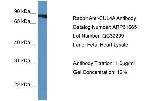 Western Blotting (WB) image for anti-Cullin 4A (CUL4A) (Middle Region) antibody (ABIN2788865) (Cullin 4A 抗体  (Middle Region))