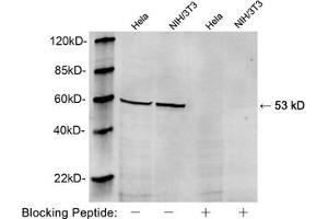 Western blot analysis of Hela and NIH/3T3 cell lysates using 1 µg/mL Rabbit Anti-Vimentin Polyclonal Antibody (ABIN398717) The signal was developed with IRDyeTM 800 Conjugated Goat Anti-Rabbit IgG (Vimentin 抗体  (AA 70-120))