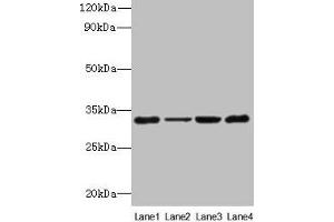Western blot All lanes: PDCD1 antibody at 6 μg/mL Lane 1: 293T whole cell lysate Lane 2: Hela whole cell lysate Lane 3: K562 whole cell lysate Lane 4: Mouse stomach tissue Secondary Goat polyclonal to rabbit IgG at 1/10000 dilution Predicted band size: 32 kDa Observed band size: 32 kDa
