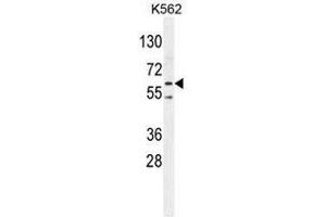 PRKAA2 (Thr172) Antibody western blot analysis in K562 cell line lysates (35µg/lane). (PRKAA2 抗体  (Middle Region, Thr172))