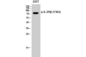 Western Blotting (WB) image for anti-Interleukin 2 Receptor, beta (IL2RB) (pTyr364) antibody (ABIN3182267) (IL2 Receptor beta 抗体  (pTyr364))