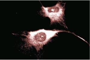 Immunofluorescence staining of Human Endothelial cells. (CD38 抗体  (AA 171-292))